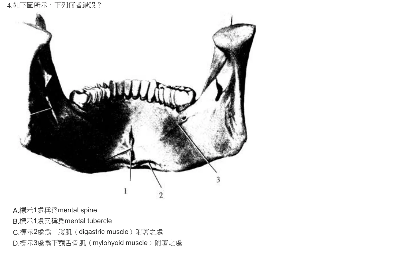 102 年第一次 牙醫學（一） 第 4 題附圖