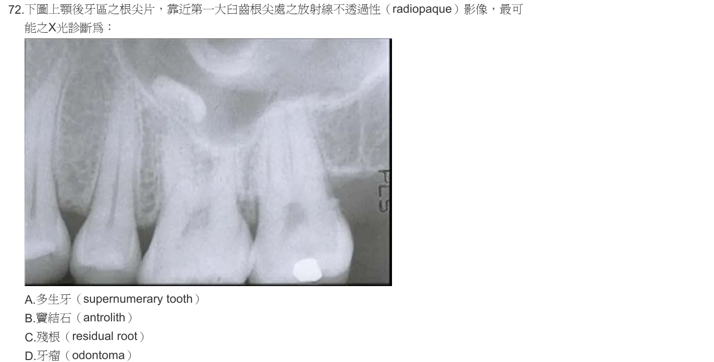 102 年第一次 牙醫學（四） 第 72 題附圖