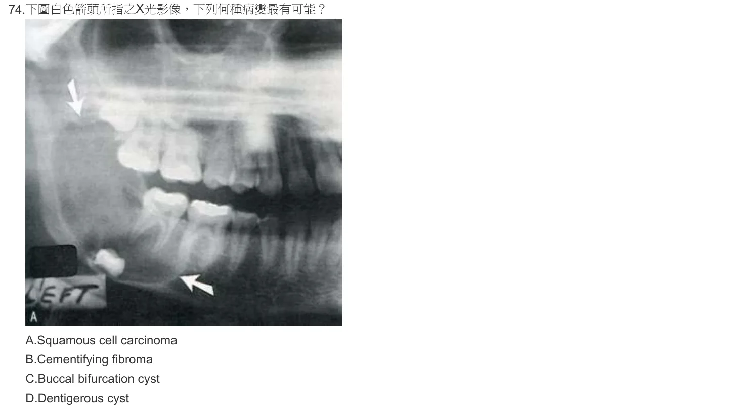 102 年第一次 牙醫學（四） 第 74 題附圖
