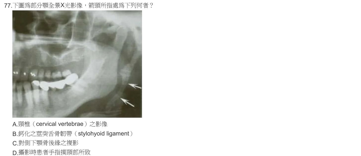 102 年第一次 牙醫學（四） 第 77 題附圖