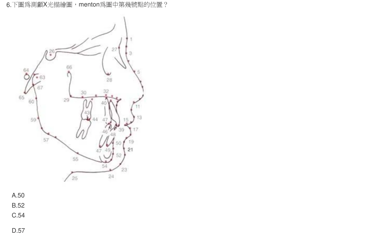 102 年第二次 牙醫學(六) 第 6 題附圖