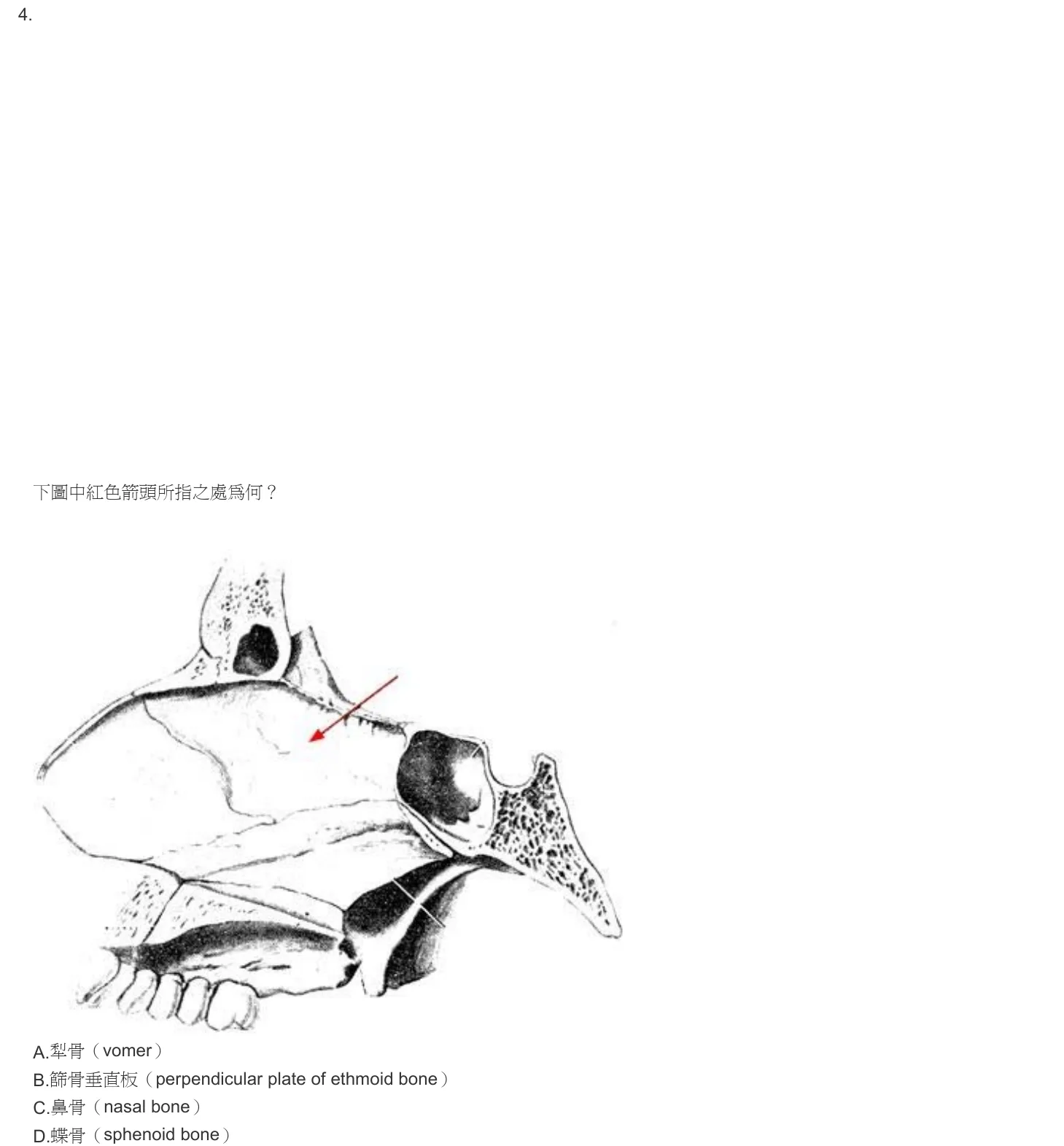 103 年第一次 牙醫學(一) 第 4 題附圖