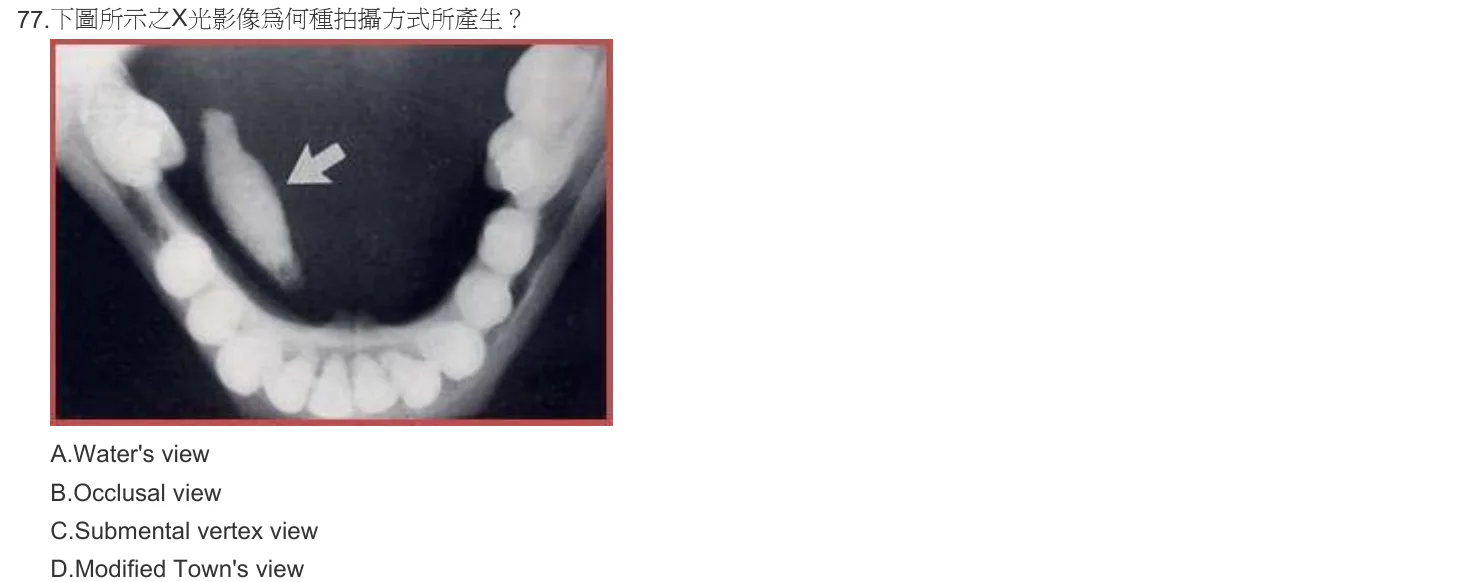 103 年第一次 牙醫學（四） 第 77 題附圖