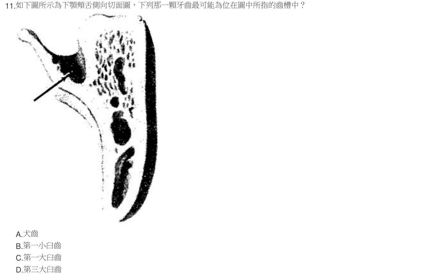 103 年第二次 牙醫學(一) 第 11 題附圖