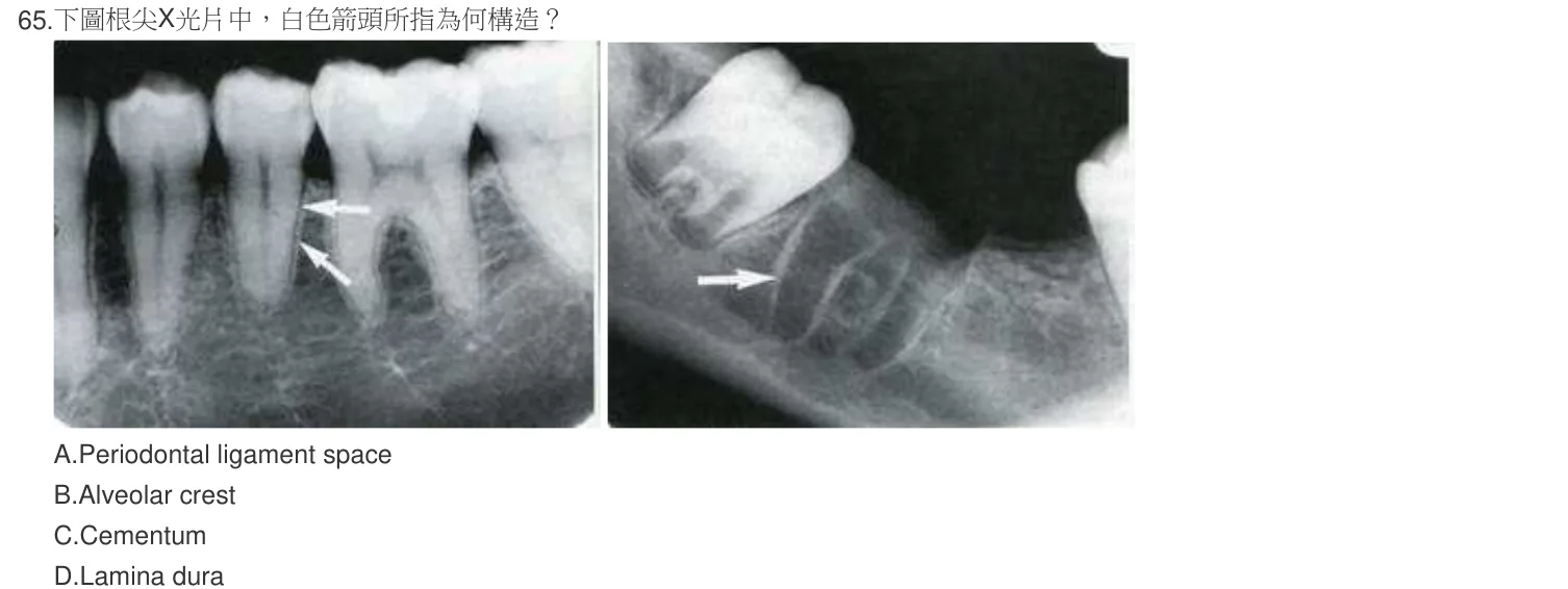 103 年第二次 牙醫學（四） 第 65 題附圖