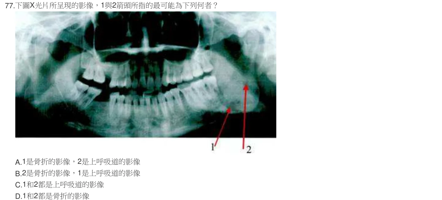 103 年第二次 牙醫學（四） 第 77 題附圖