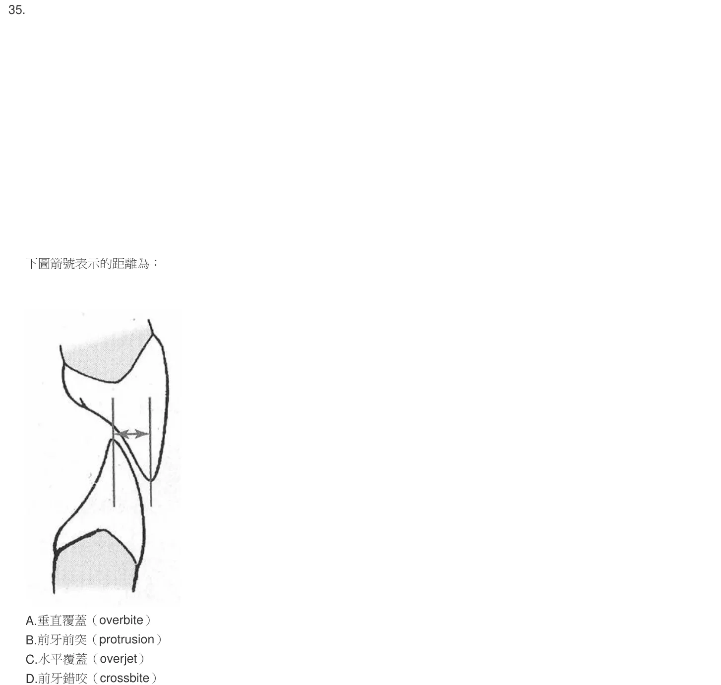 104 年第二次 牙醫學（一） 第 35 題附圖