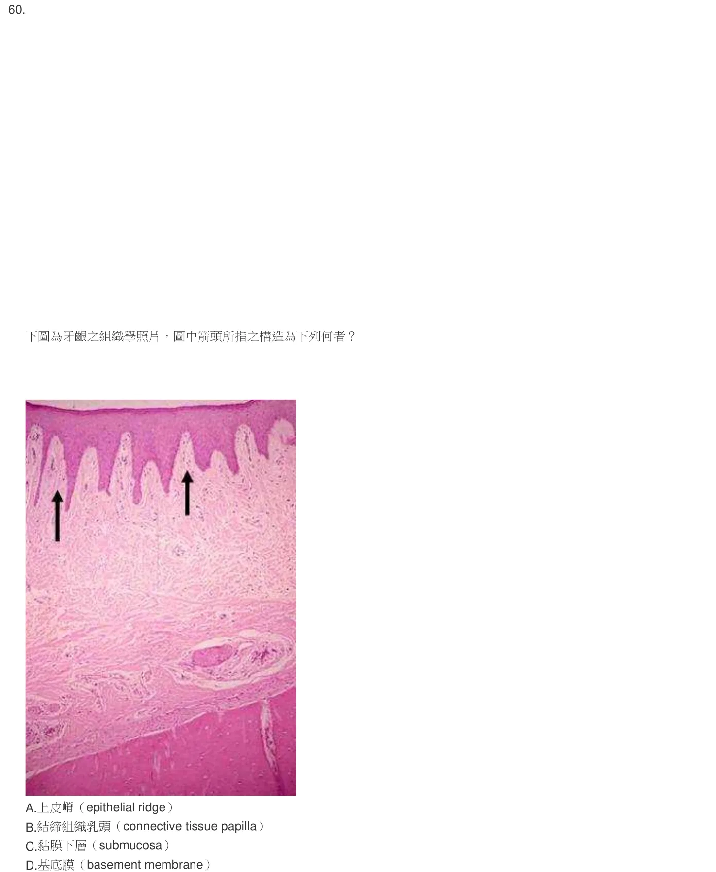 104 年第二次 牙醫學（一） 第 60 題附圖