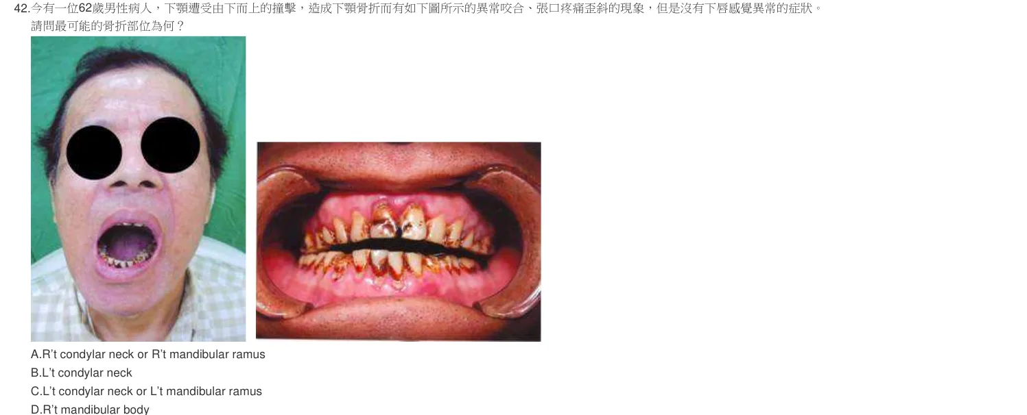 104 年第二次 牙醫學（四） 第 42 題附圖