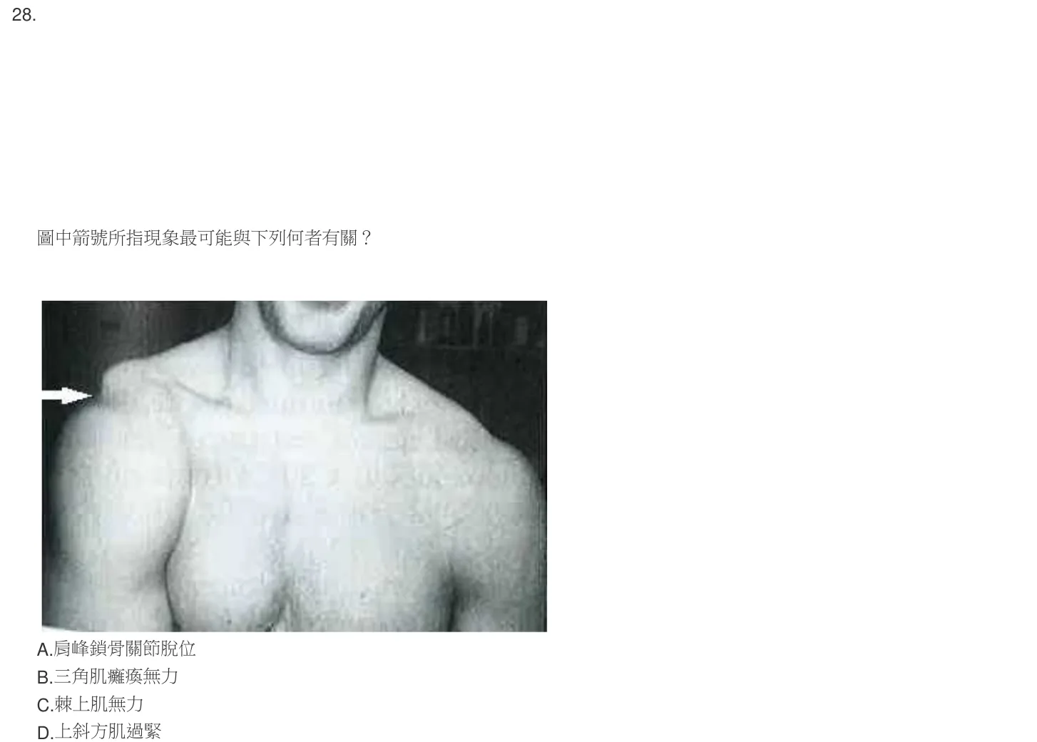104 年第二次 骨科疾病物理治療學 第 28 題附圖
