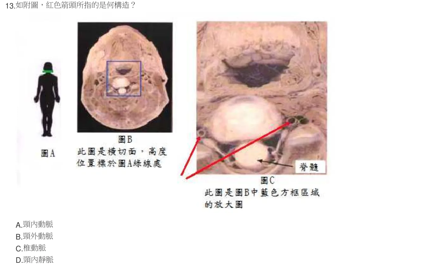 104 年第二次 解剖學與生理學 第 13 題附圖