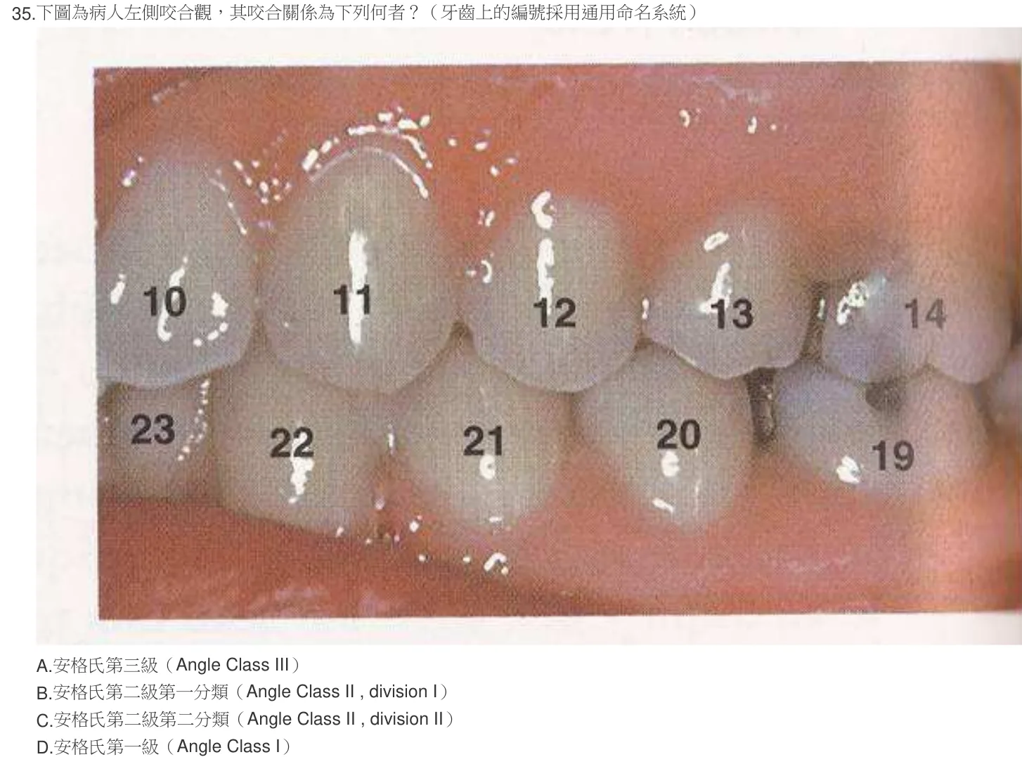 105 年第一次 牙醫學（一） 第 35 題附圖
