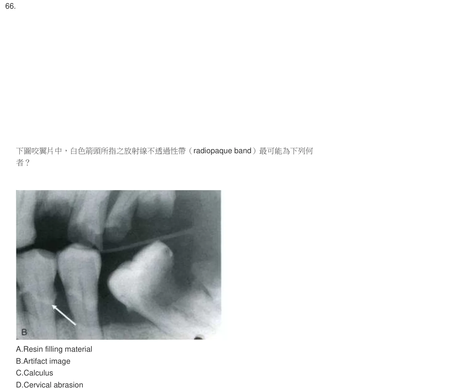 105 年第一次 牙醫學（四） 第 66 題附圖