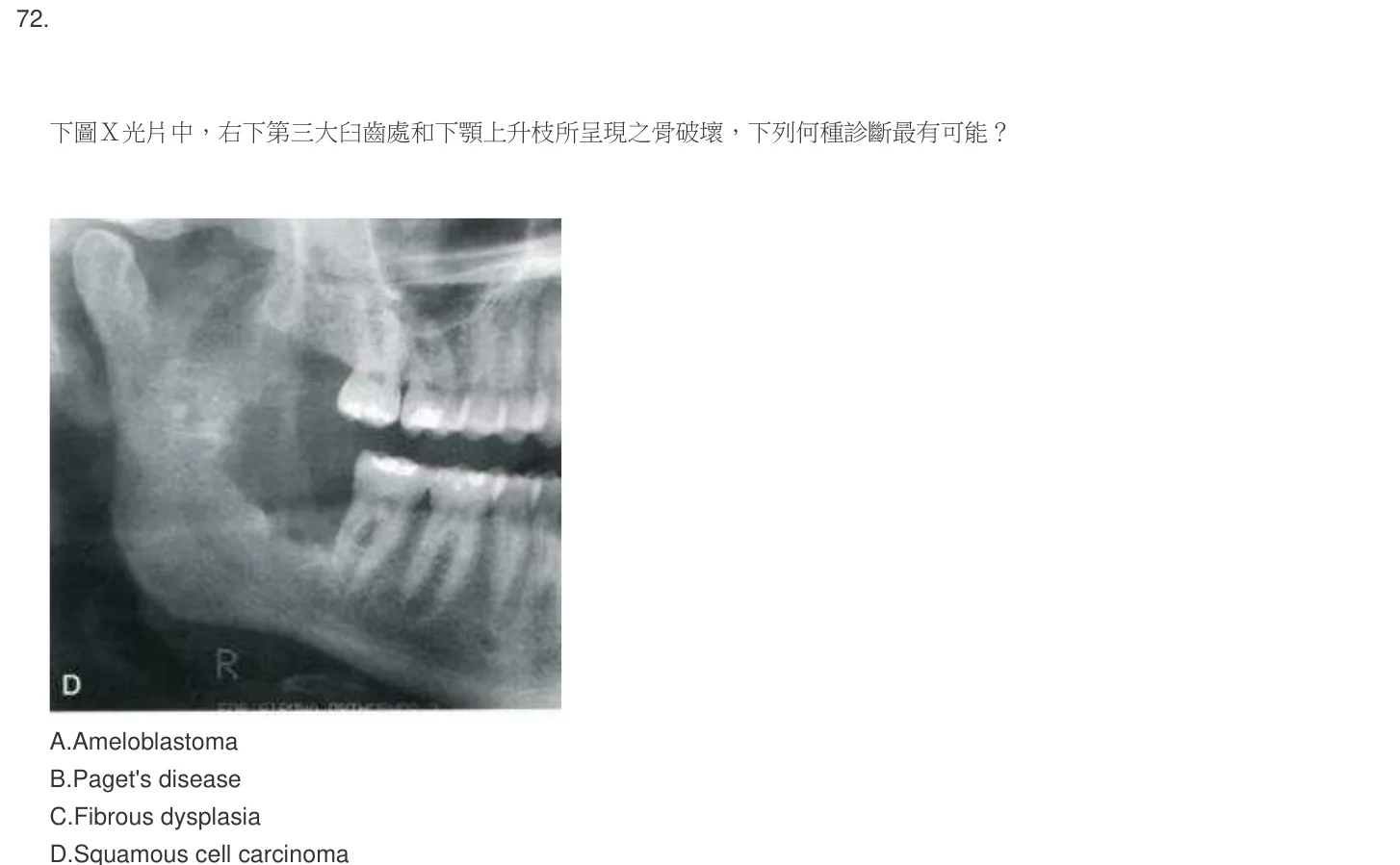 105 年第一次 牙醫學（四） 第 72 題附圖
