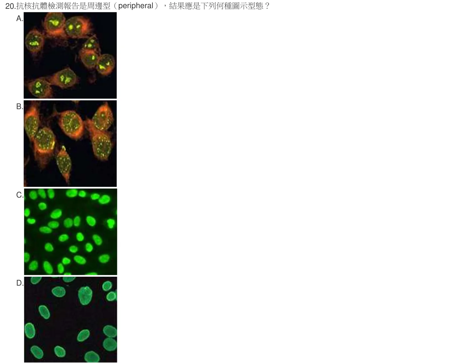 105 年第一次 臨床血清免疫學與臨床病毒學 第 20 題附圖