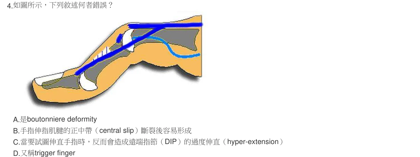 105 年第一次 職能治療技術學 第 4 題附圖