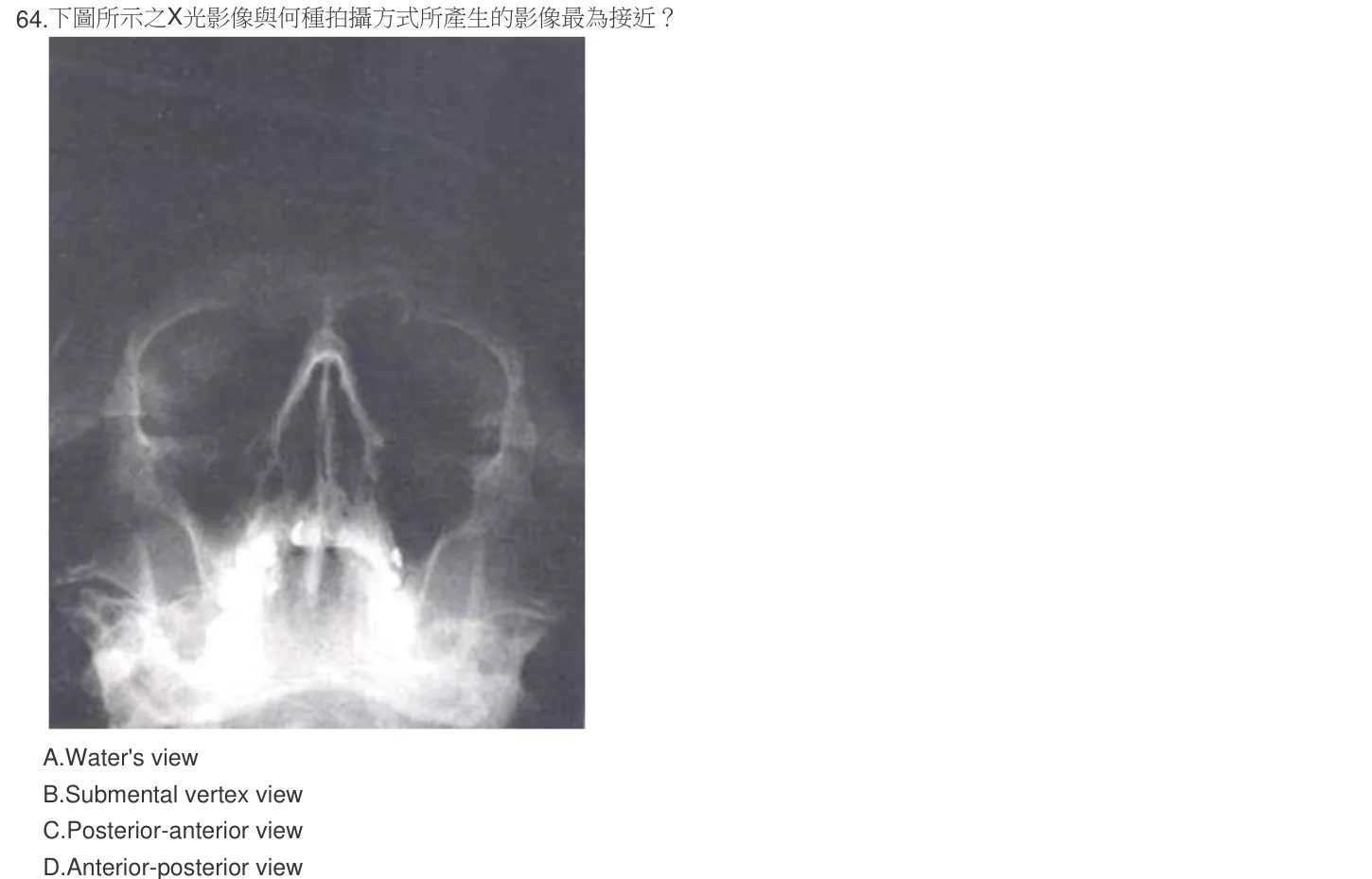 105 年第二次 牙醫學（四） 第 64 題附圖