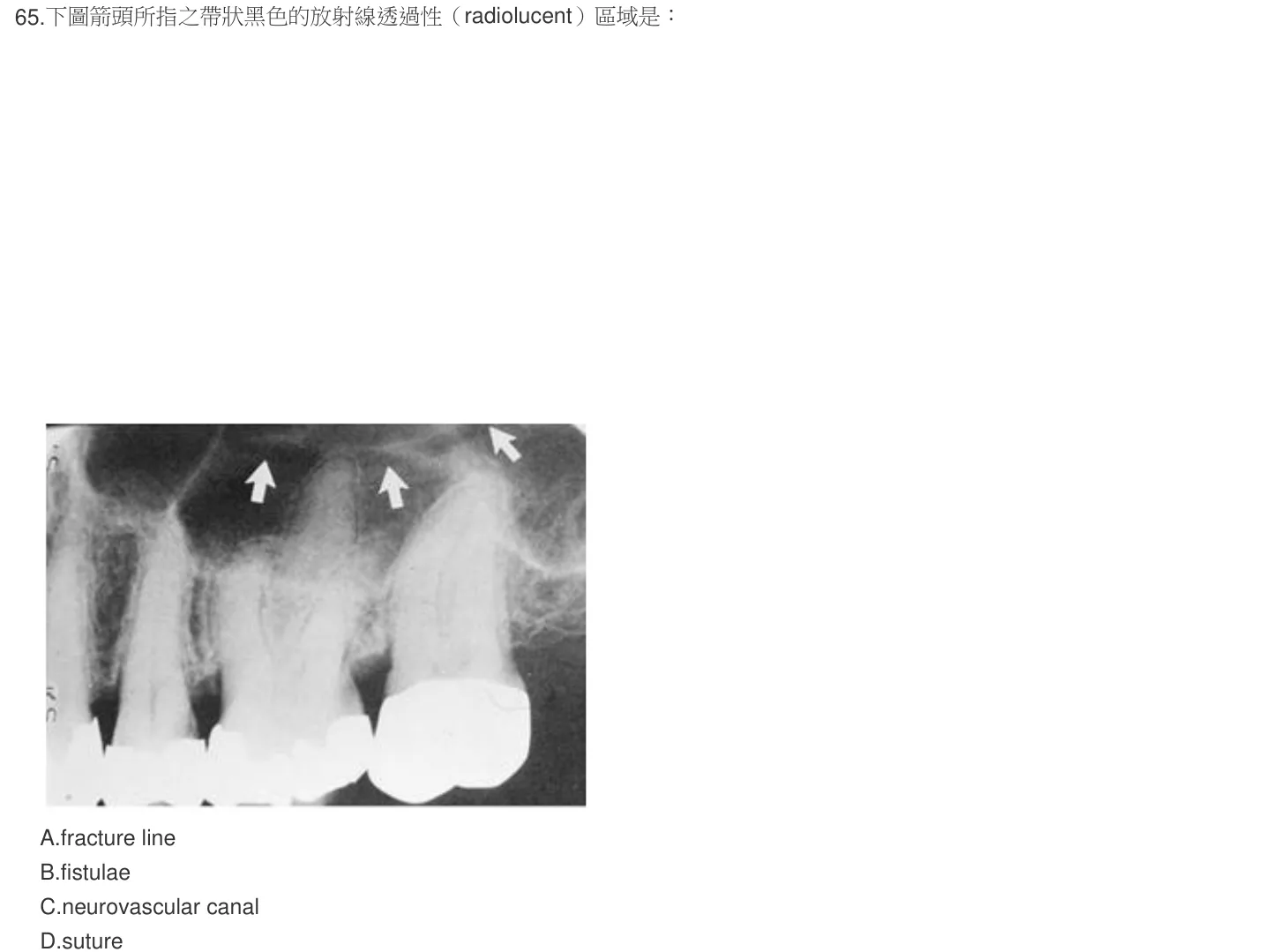 105 年第二次 牙醫學（四） 第 65 題附圖