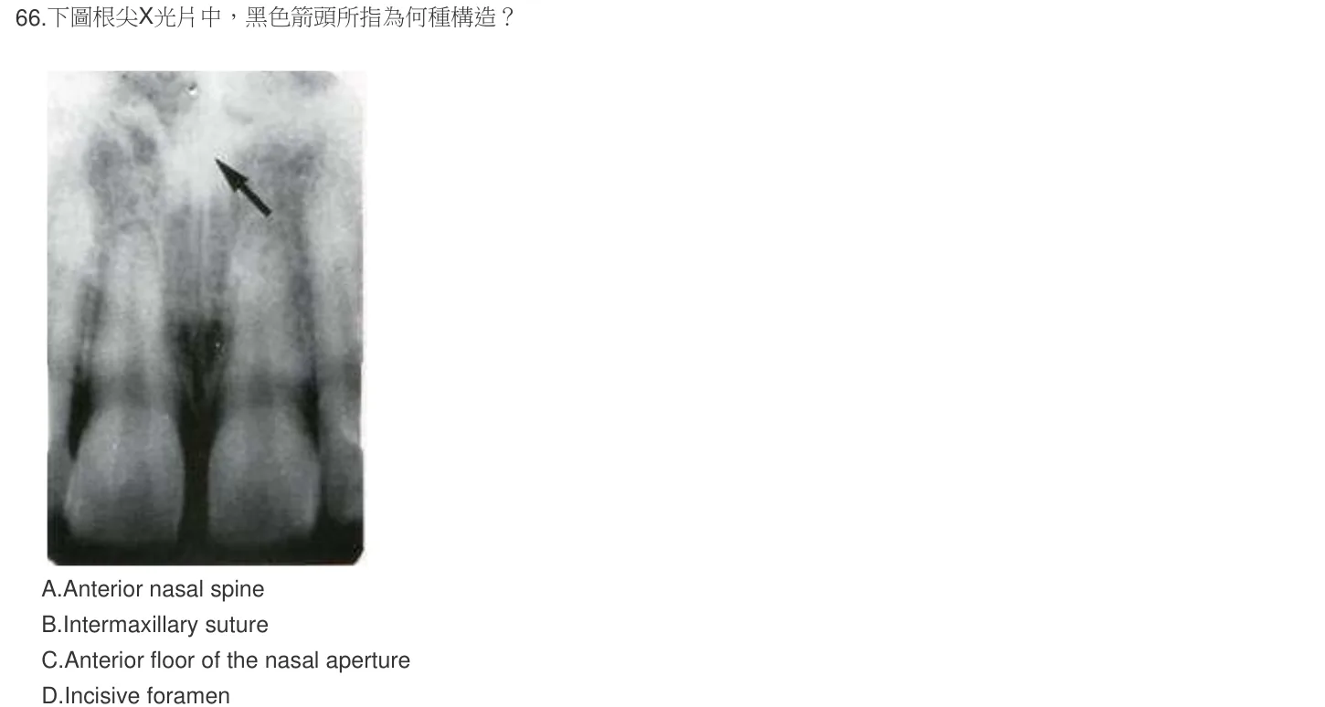 105 年第二次 牙醫學（四） 第 66 題附圖