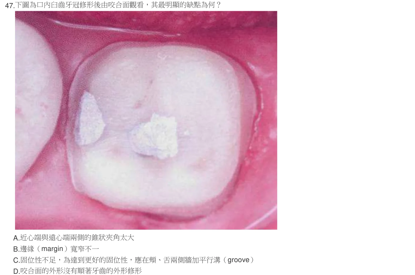 106 年第一次 牙醫學（五） 第 47 題附圖