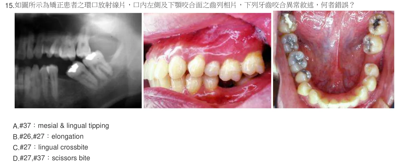 106 年第一次 牙醫學（六） 第 15 題附圖