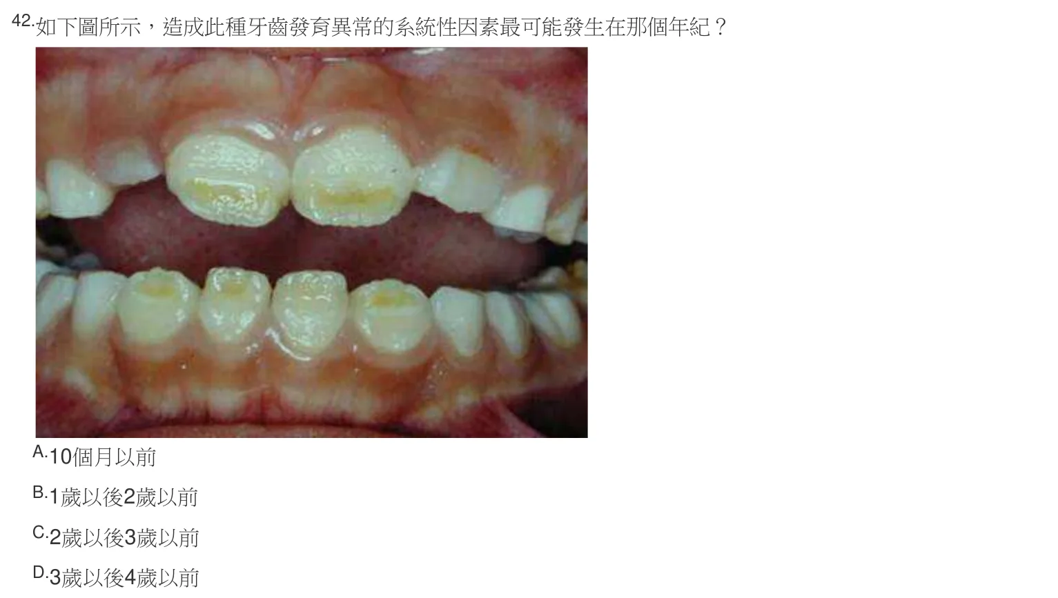106 年第二次 牙醫學（六） 第 42 題附圖