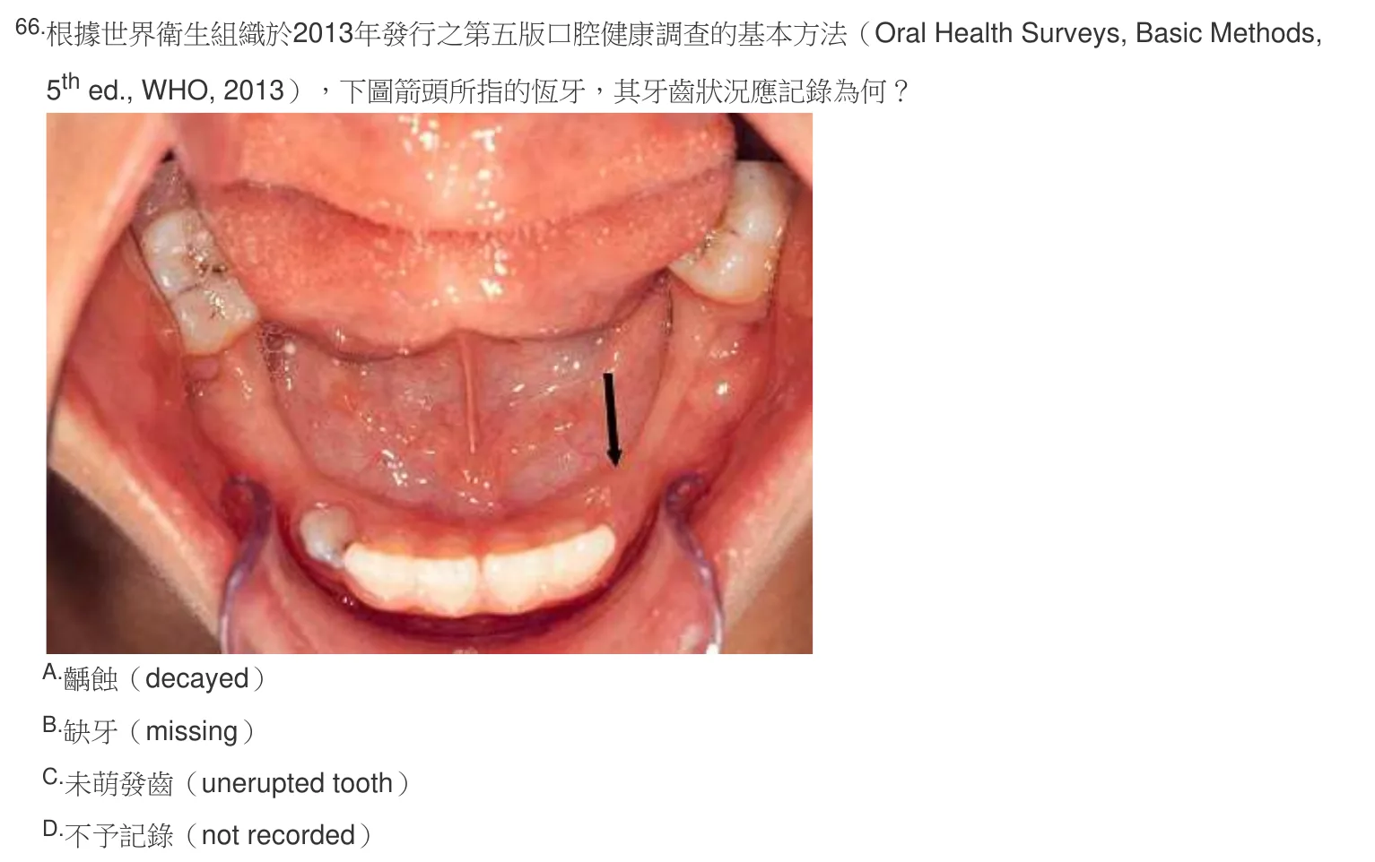106 年第二次 牙醫學（六） 第 66 題附圖