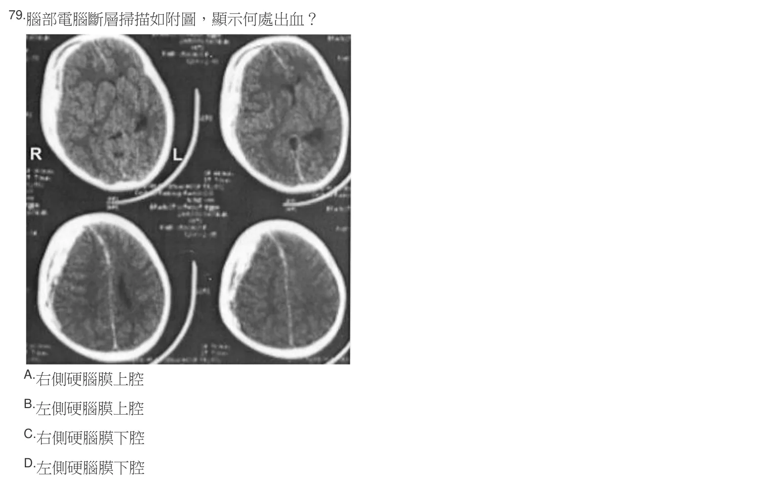 106 年第二次 物理治療學概論 第 79 題附圖
