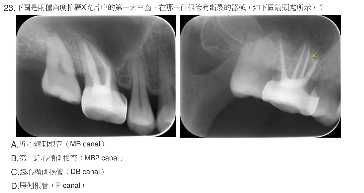 107 年第一次 牙醫學(三) 第 23 題附圖