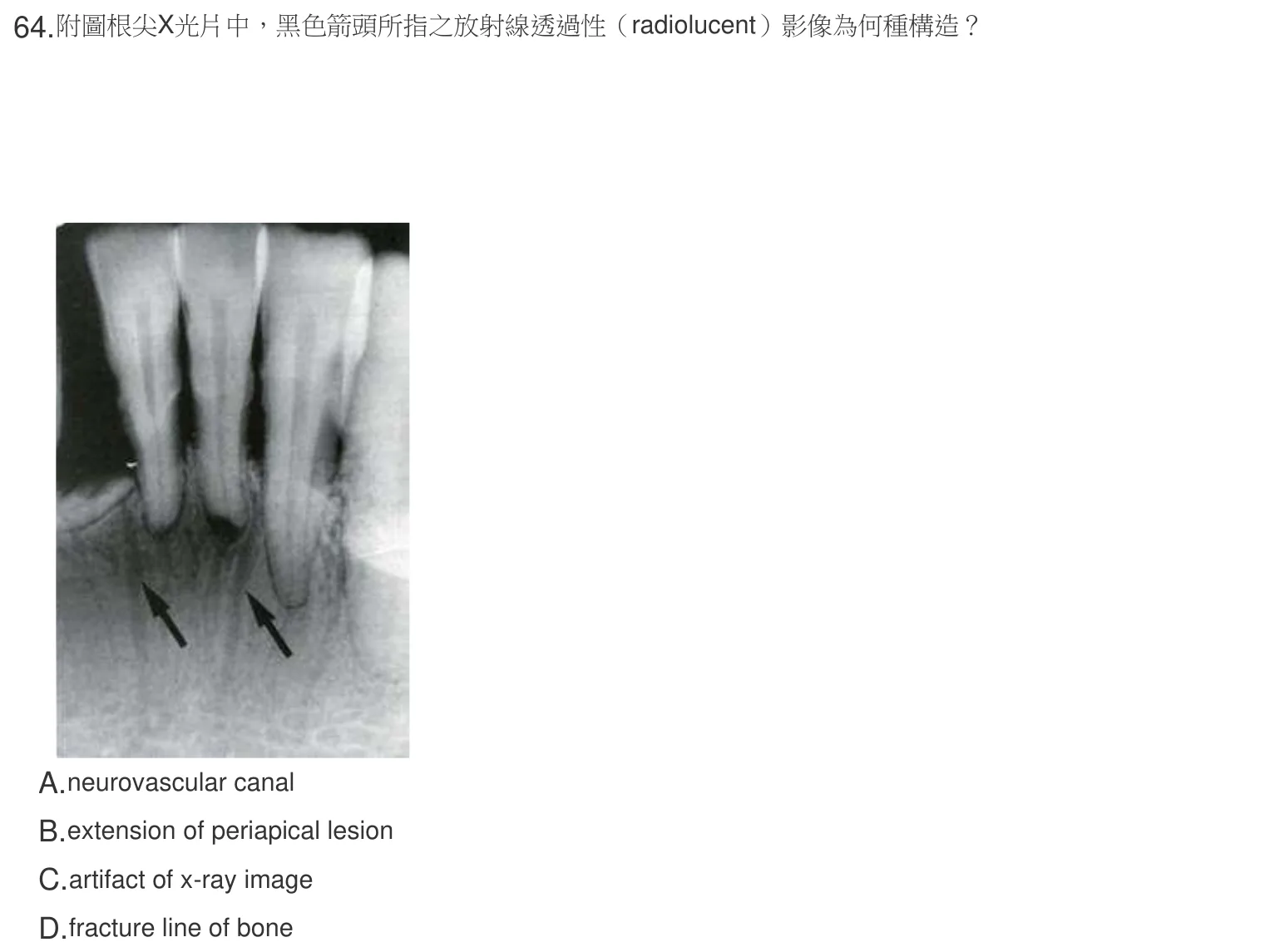 107 年第一次 牙醫學(四) 第 64 題附圖