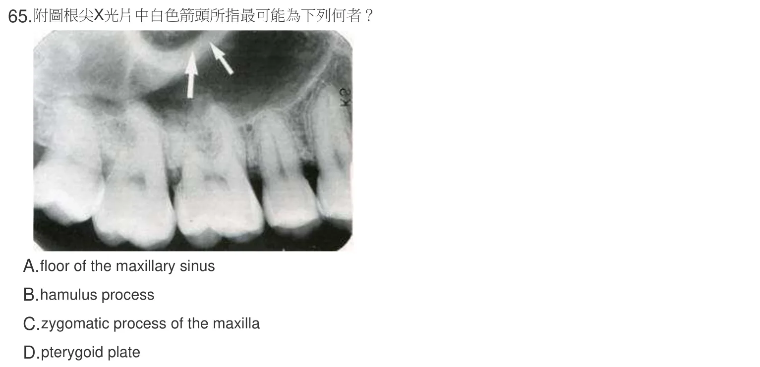 107 年第一次 牙醫學(四) 第 65 題附圖