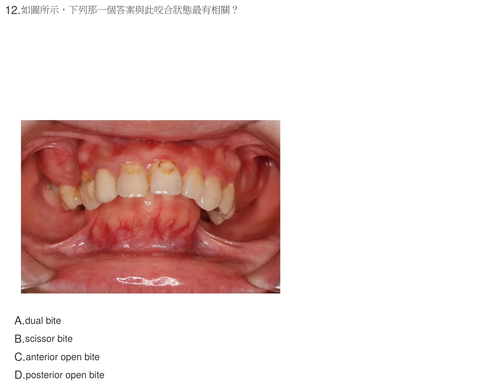 107 年第一次 牙醫學（六） 第 12 題附圖