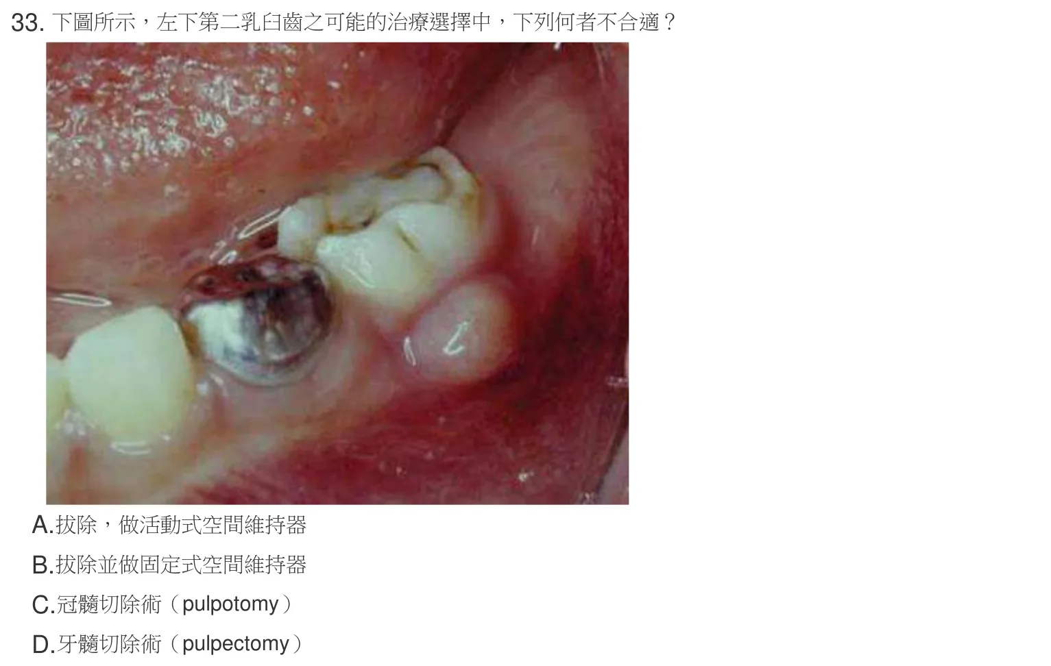 107 年第一次 牙醫學（六） 第 33 題附圖