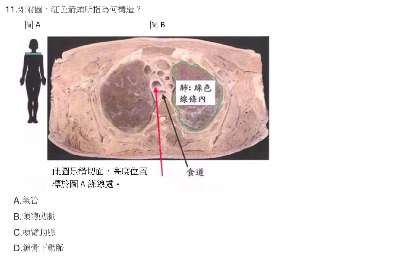 107 年第一次 解剖學與生理學 第 11 題附圖
