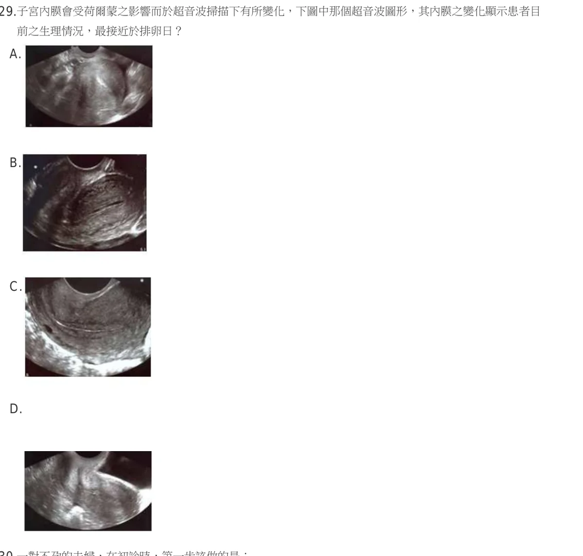 107 年第二次 醫學（六） 第 29 題附圖
