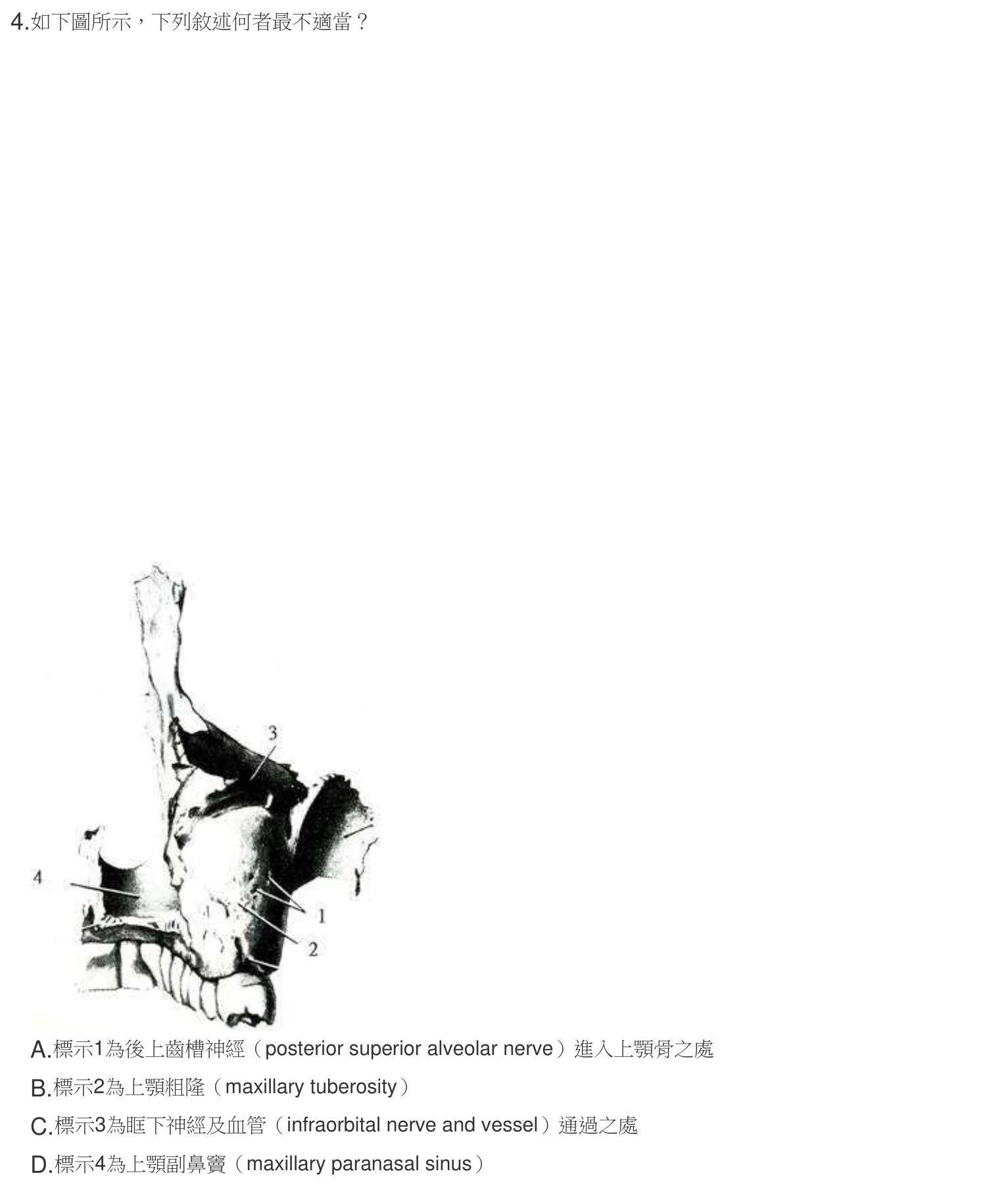 107 年第二次 牙醫學（一） 第 4 題附圖