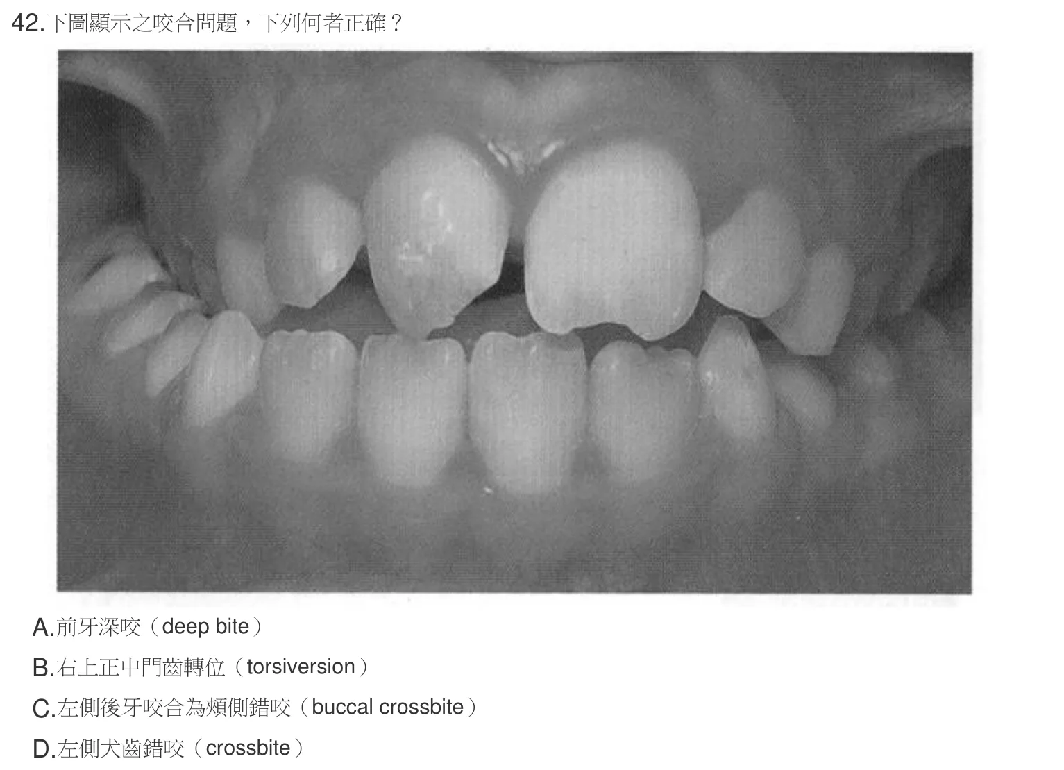 107 年第二次 牙醫學（一） 第 42 題附圖