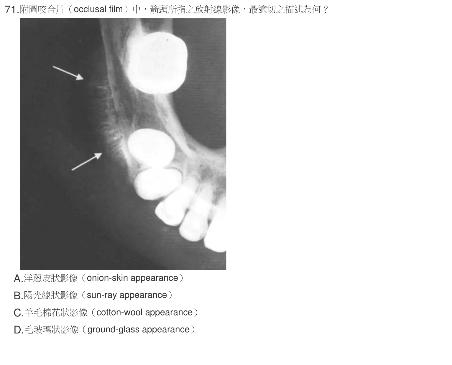 107 年第二次 牙醫學(四) 第 71 題附圖