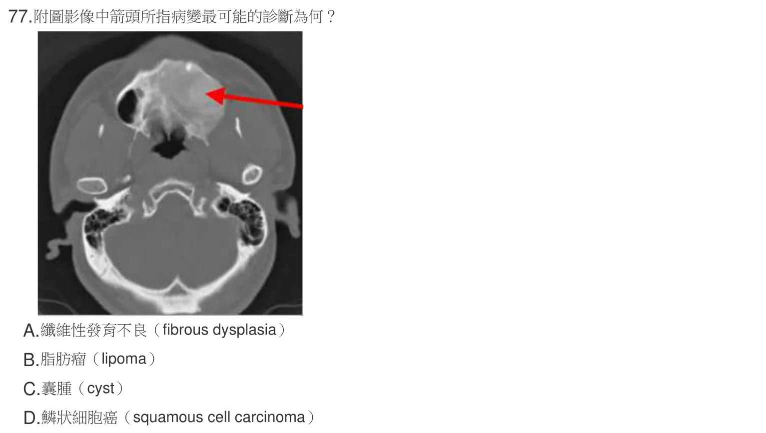 107 年第二次 牙醫學(四) 第 77 題附圖