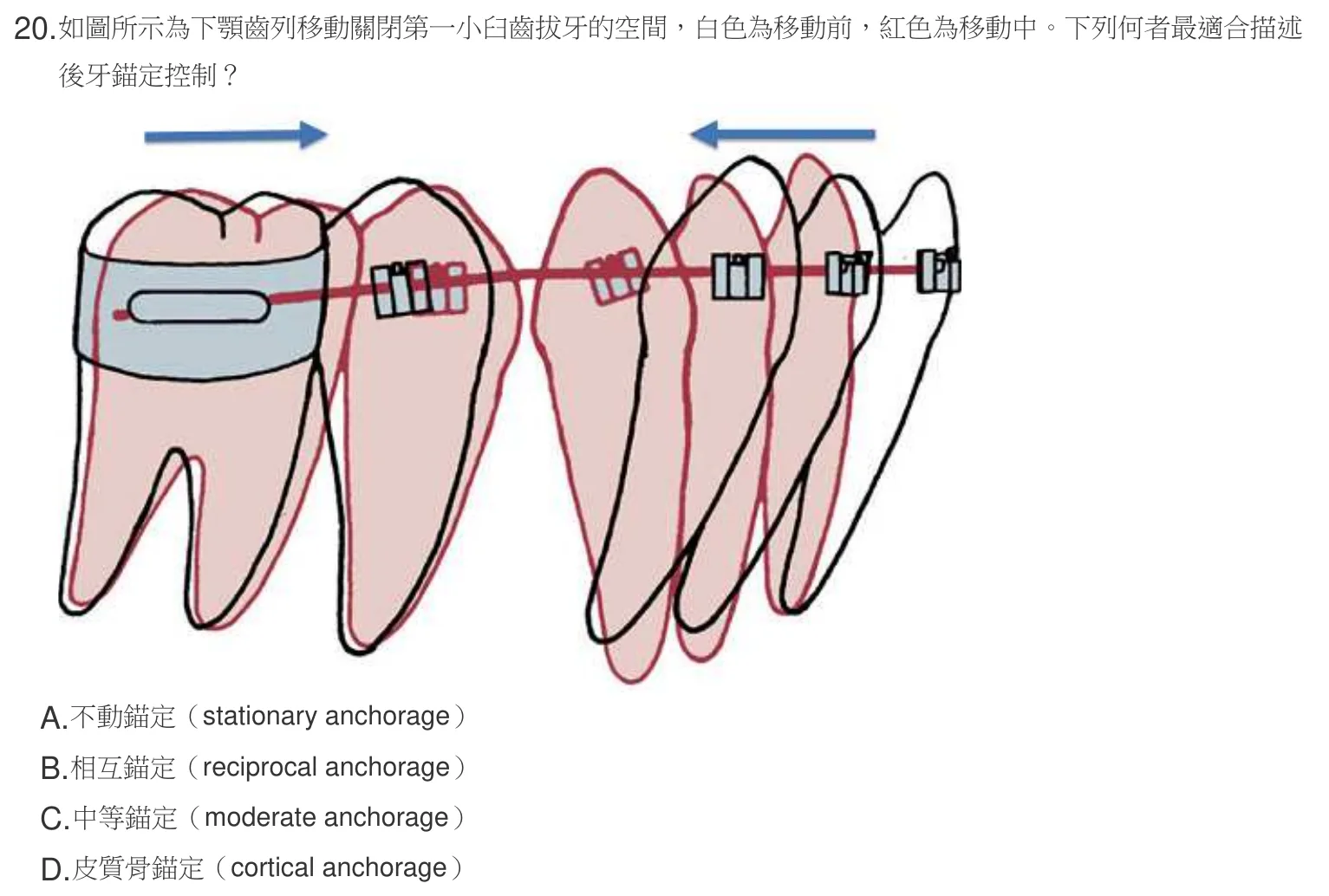 107 年第二次 牙醫學（六） 第 20 題附圖
