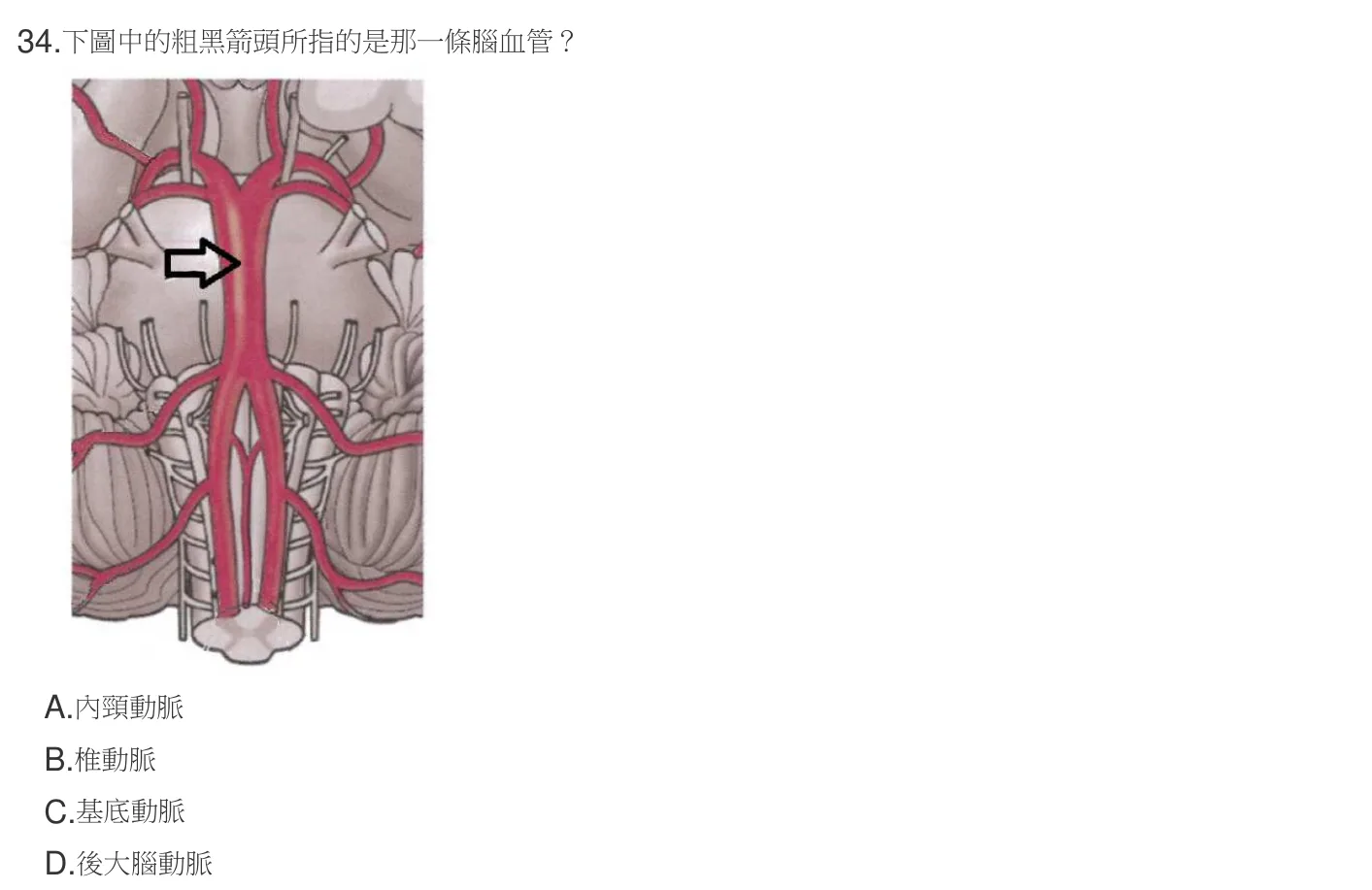 107 年第二次 神經疾病物理治療學 第 34 題附圖
