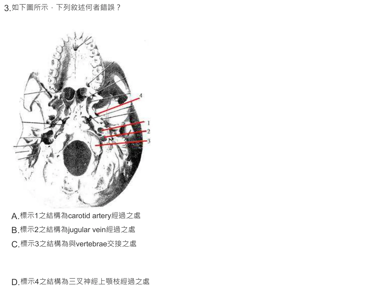 108 年第一次 牙醫學(一) 第 3 題附圖