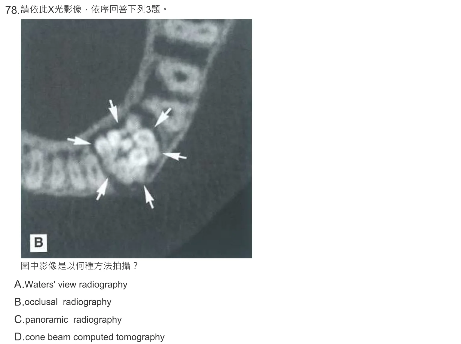 108 年第一次 牙醫學(四) 第 78 題附圖