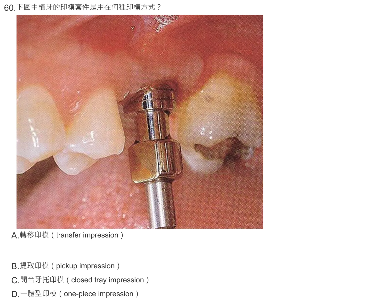 108 年第一次 牙醫學(五) 第 60 題附圖