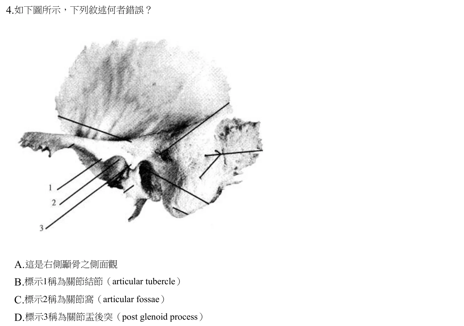 108 年第二次 牙醫學（一） 第 4 題附圖