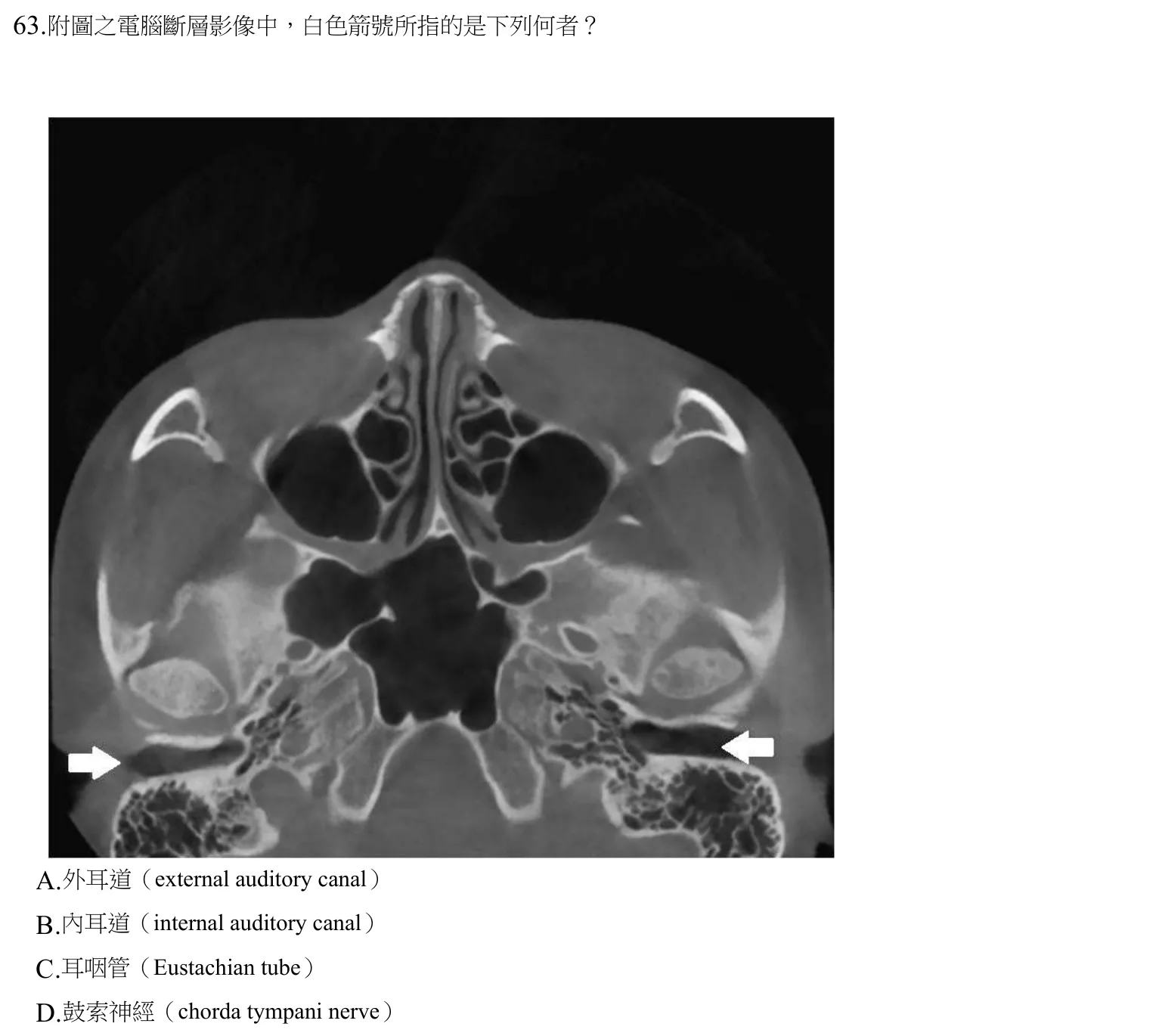 108 年第二次 牙醫學(四) 第 63 題附圖
