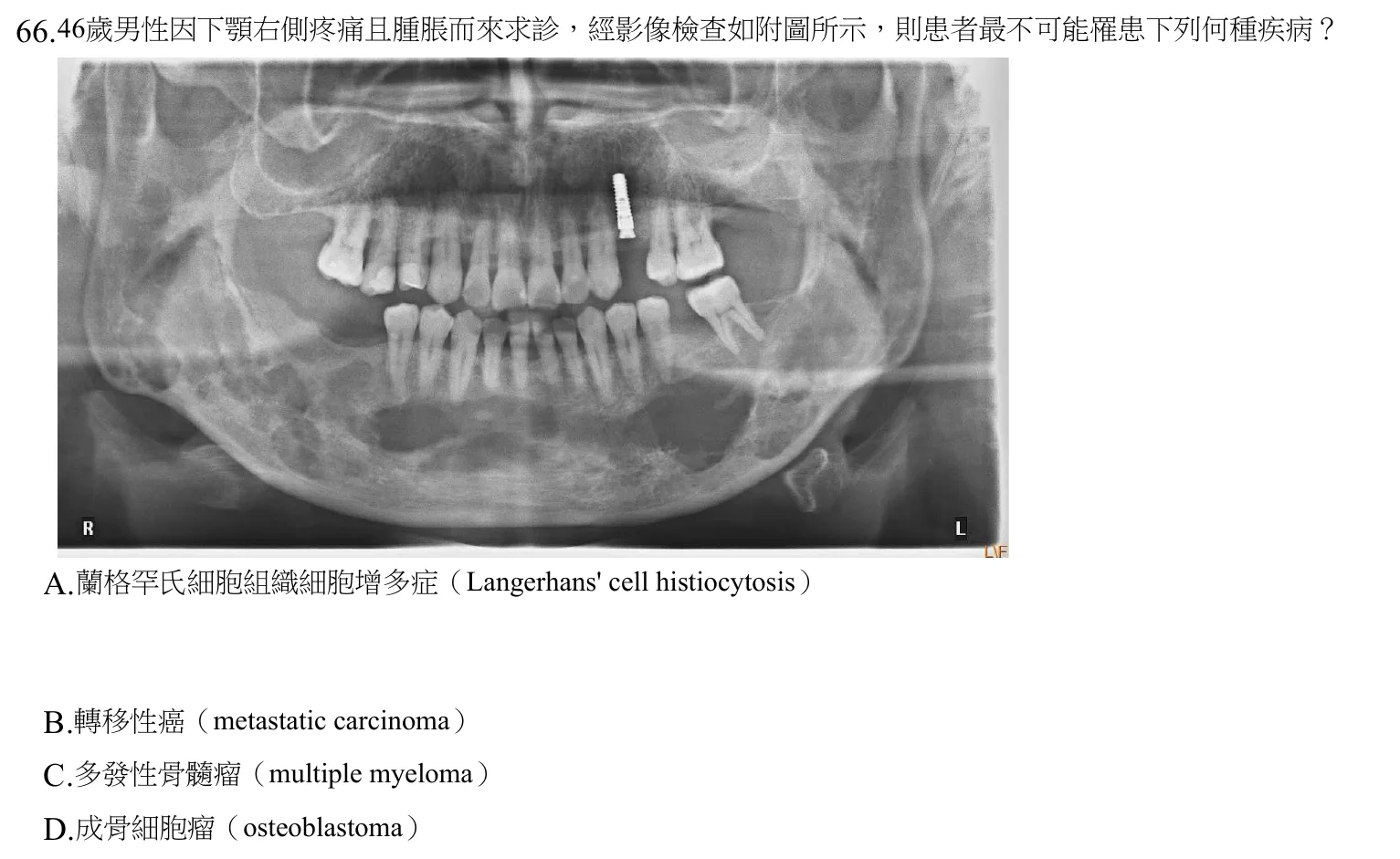 108 年第二次 牙醫學(四) 第 66 題附圖