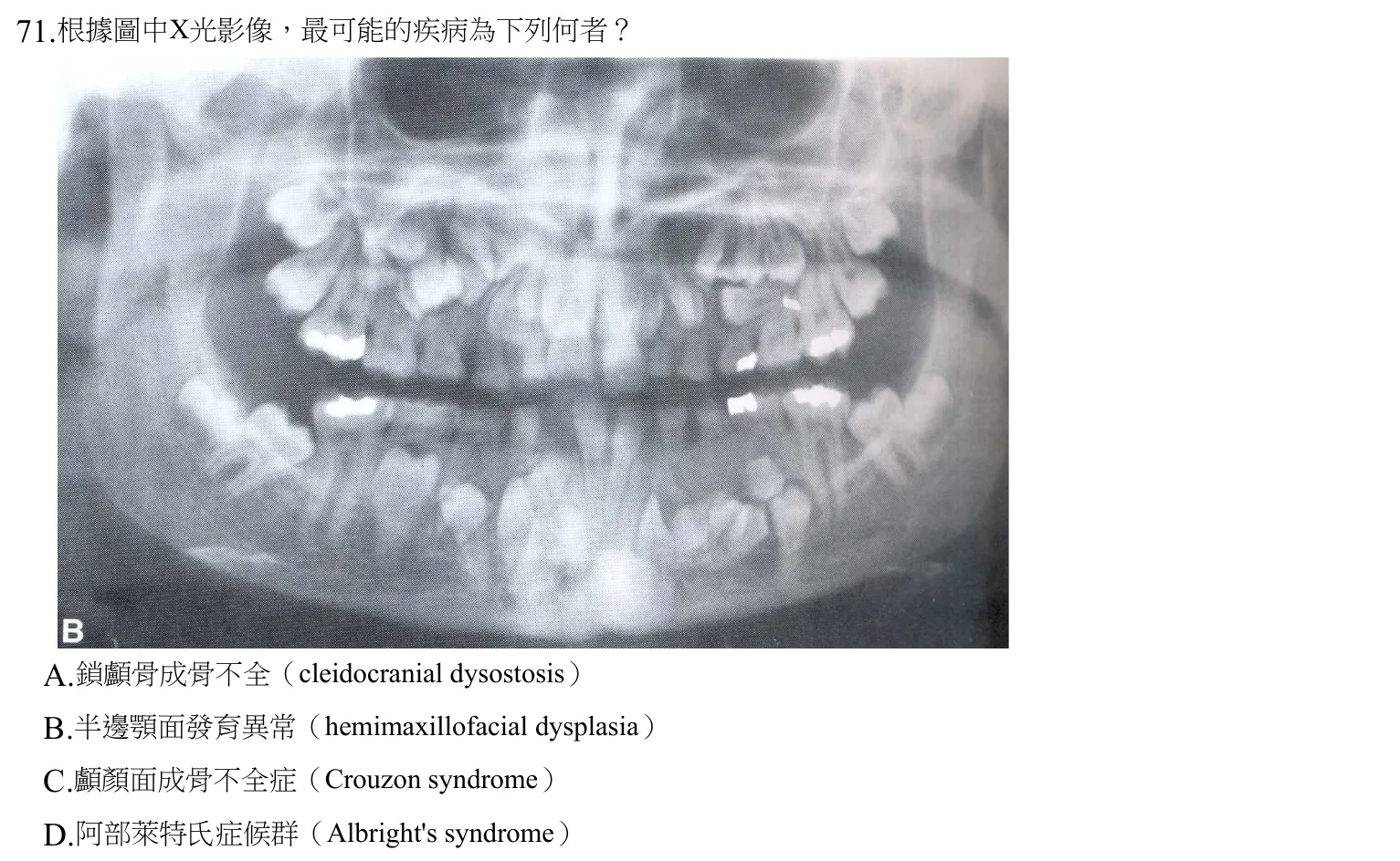 108 年第二次 牙醫學(四) 第 71 題附圖