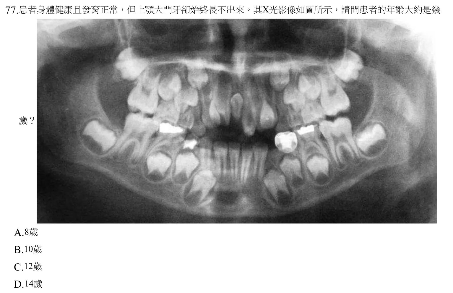 108 年第二次 牙醫學(四) 第 77 題附圖
