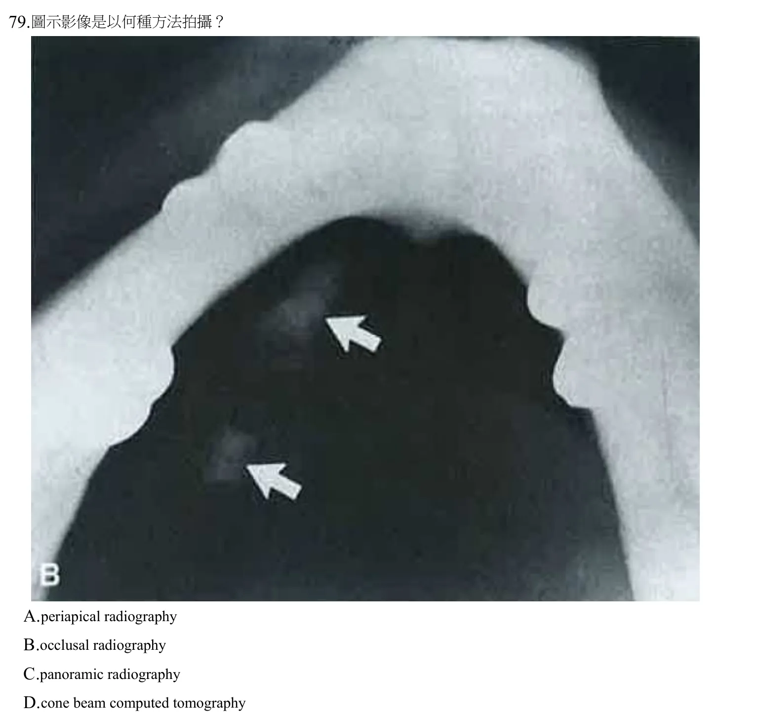 108 年第二次 牙醫學(四) 第 79 題附圖